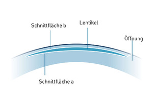 Lentikel-Erstellung